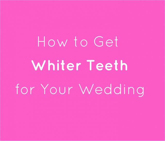 how to get whiter teeth for wedding